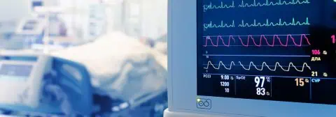 monitor op ic afdeling